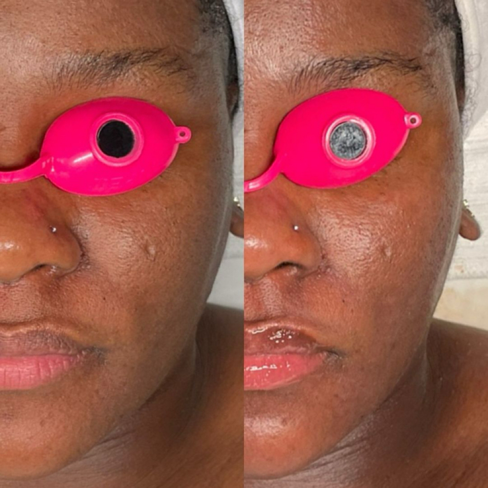 Glowing, freshly treated skin after a customized facial